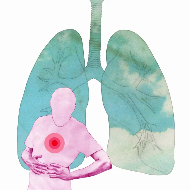 Illustration zum Thema Lungenembolie für den Focus. #focus_magazin #birgitlangillustration #lungenembolie #lung #lunge